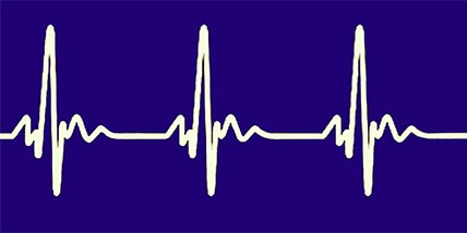 Stylized electrocardiogram waveform representing cardiac signal acquisition