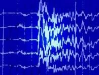 Electroencephalogram traces showing seizure-related neural activity